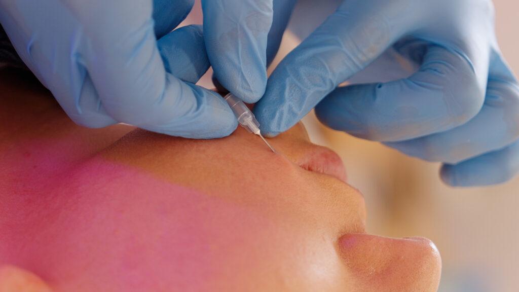Karel Gruyaert - Botox / Amela