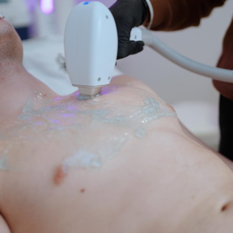 Karel Gruyaert - Laser ontharing